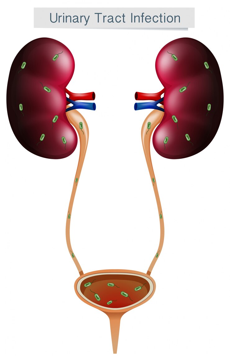 My approved research for UTI management and treatment efficiency in Iran. 